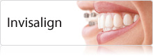 Invisalign Toronto - Invisalign Markham